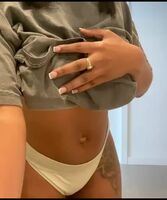 Miracle Watts
