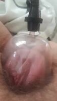 inflates like a balloon